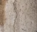 Hairline Fracture